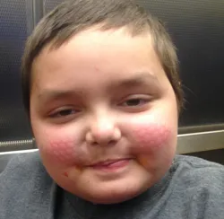 Ethan Fox